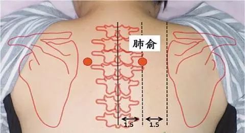 艾灸治疗失眠