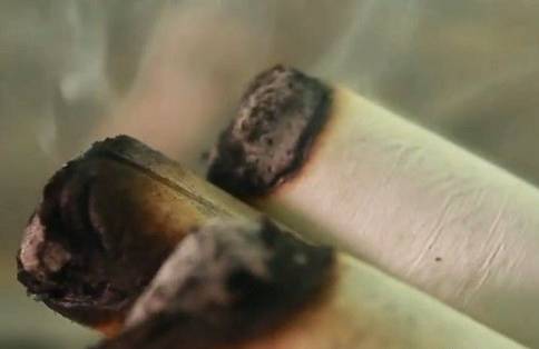 肩周炎的症状,肩周炎艾灸调理效果好吗?