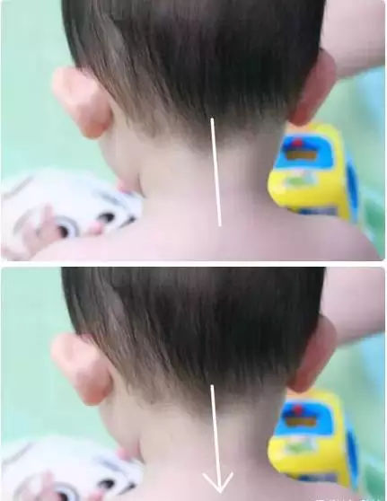 小儿推拿真人高清图解