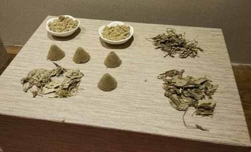 艾灸养生有4种好处3个禁忌,正确调理能健脾养胃