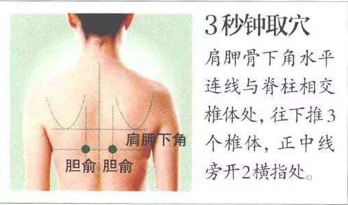 胆结石尿路结石食艾灸疗法