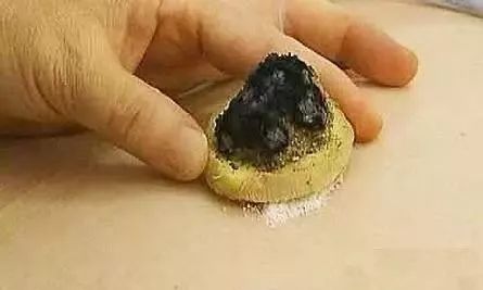 预防新型肺炎传染,提升阳气艾灸这三穴!