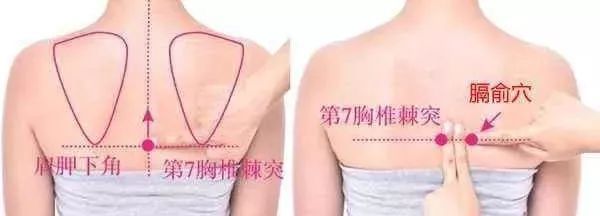 贫血怎么办?艾灸膈俞穴!