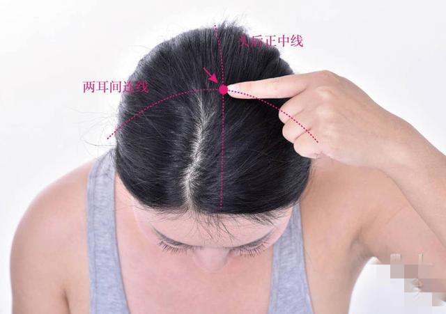 经期头痛怎样艾灸?灸哪些穴位?