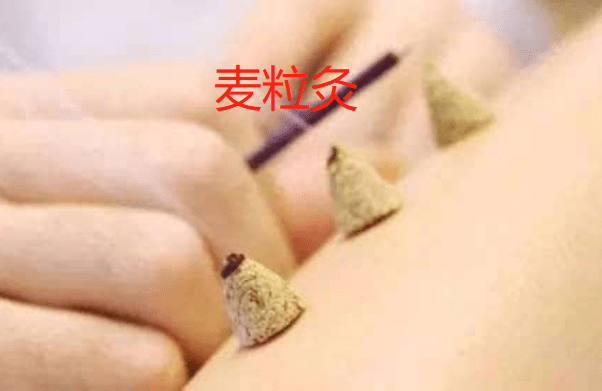麦粒灸的适应范围与选穴
