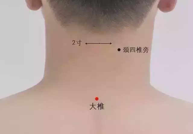 艾灸预防＂新冠肺炎＂小贴士