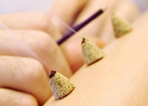 马氏温灸法:这些病主要艾灸患处!
