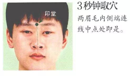 头痛论治,前额头痛怎么艾灸