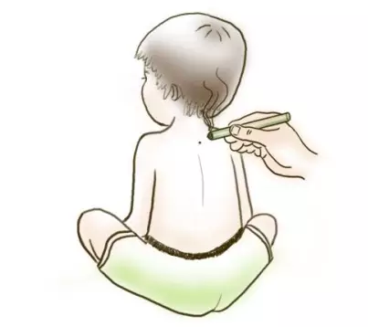 孩子艾灸养生保健的穴位及方法