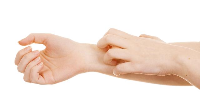 皮肤痒,是体内阳气不达,经常痒长湿疹这样艾灸!