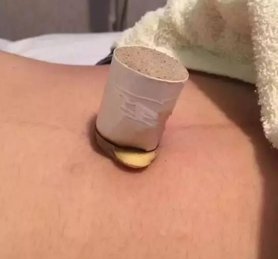 隔物灸做艾灸的效果翻几番