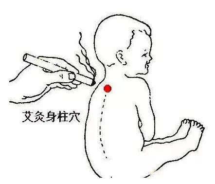 艾灸能天天做吗?长期艾灸到底有什么好