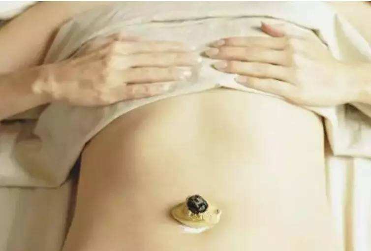 艾灸肚子对女性的好处