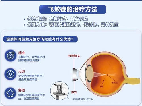 飞蚊症换玻璃体配图