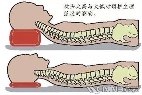 颈椎病枕黄玻璃树睡觉可以不配图