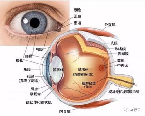 眼睛玻璃体换足可以配图