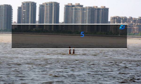 (5)亨廷顿舞蹈症的致病原因是什么图片