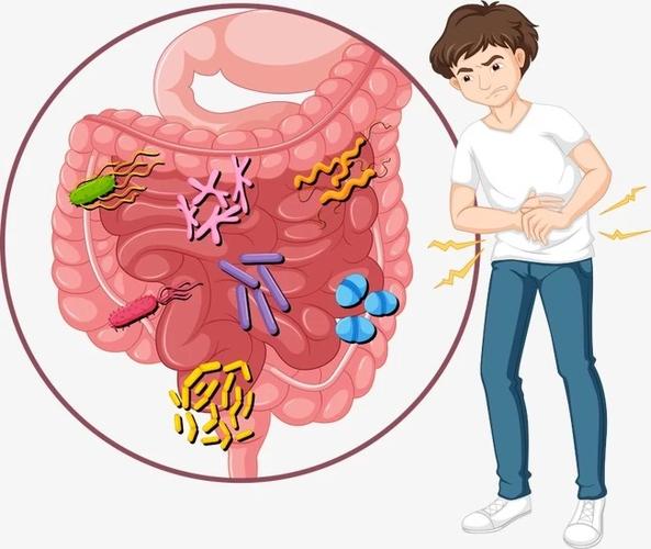 肠梗阻的症状及治疗吃什么药图片配图