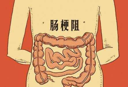 肠梗阻相当于中医什么病配图