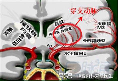 冠腔梗是什么意思配图