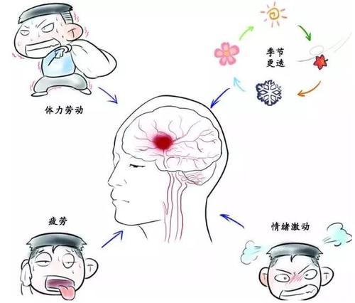 脑梗出血的症状是什么配图