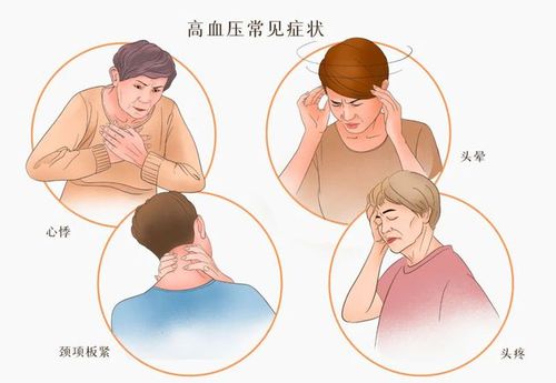 脑梗是不是头疼头昏是什么症状配图