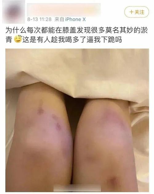 女的膝盖有伤是什么梗配图