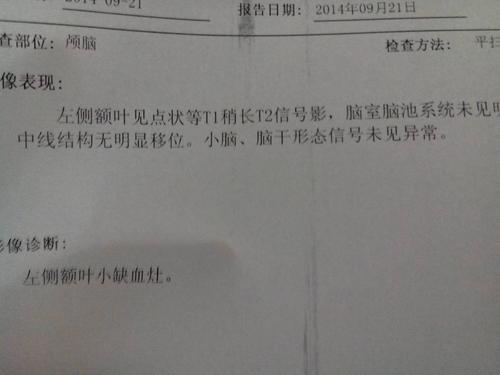 缺血性梗死灶是什么意思配图