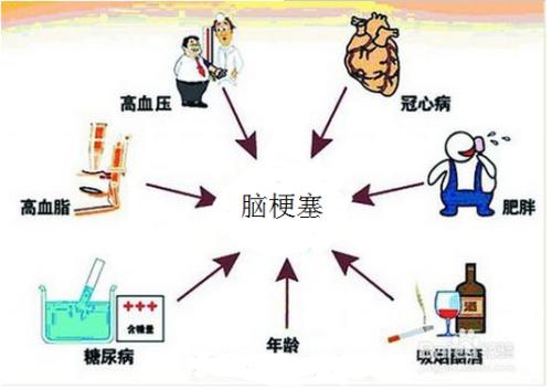 什么原因容易引起心肌梗塞配图