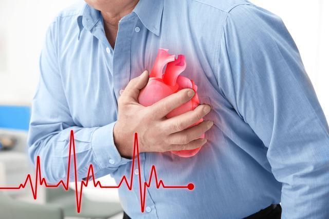 心梗发作是什么症状配图