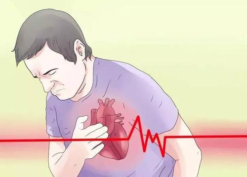 心肌梗塞是什么症状?配图