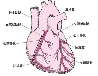心肌心肌梗塞是什么原因引起的配图