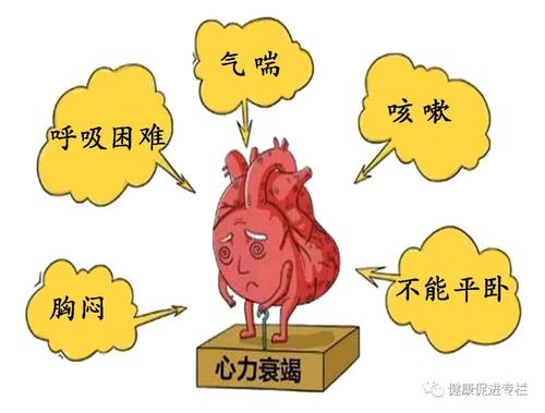 心脏急性梗塞是什么意思配图