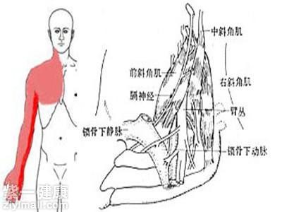 胸导管出口梗阻是什么造成的配图