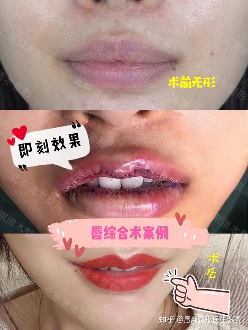 嘴唇厚什么梗配图